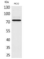 Fig.1. Western Blot analysis of PC12 cells using SAMHD1 Polyclonal Antibody. Secondary antibody (catalog#: A21020) was diluted at 1:20000.