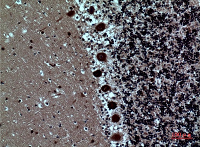 Fig.2. Immunohistochemical analysis of paraffin-embedded human-brain, antibody was diluted at 1:100.