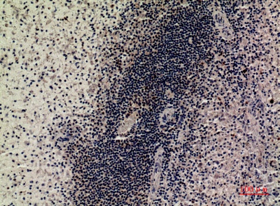 Fig.3. Immunohistochemical analysis of paraffin-embedded human-spleen, antibody was diluted at 1:100.