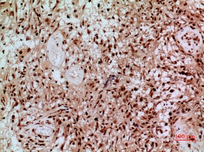 Fig.4. Immunohistochemical analysis of paraffin-embedded human-brain, antibody was diluted at 1:100.
