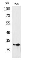 Fig.1. Western Blot analysis of PC12 cells using HLA-DQB1/2 Polyclonal Antibody. Secondary antibody (catalog#: A21020) was diluted at 1:20000.
