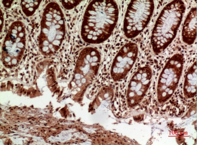 Fig.2. Immunohistochemical analysis of paraffin-embedded human-colon, antibody was diluted at 1:100.