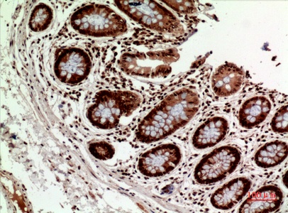 Fig.3. Immunohistochemical analysis of paraffin-embedded human-colon, antibody was diluted at 1:100.