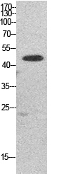 Fig. Western Blot analysis of HepG2 cells using EF-1 α1/2 Polyclonal Antibody. Secondary antibody (catalog#: A21020) was diluted at 1:20000.