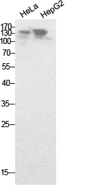 Fig.1. Western Blot analysis of hela, HepG2 cells using NCoA-3 Polyclonal Antibody. Secondary antibody (catalog#: A21020) was diluted at 1:20000.
