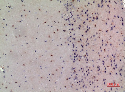 Fig.2. Immunohistochemical analysis of paraffin-embedded Mouse-brain, antibody was diluted at 1:100.