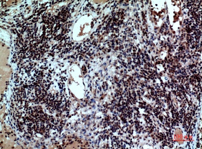 Fig.3. Immunohistochemical analysis of paraffin-embedded human-Lymph-nodes, antibody was diluted at 1:100.