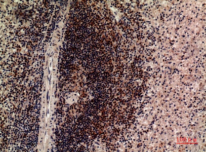 Fig.3. Immunohistochemical analysis of paraffin-embedded human-spleen, antibody was diluted at 1:100.