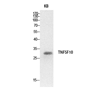 Fig.1. Western Blot analysis of hela cells using TRAIL Polyclonal Antibody. Secondary antibody (catalog#: A21020) was diluted at 1:20000.