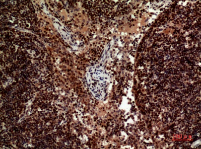 Fig.2. Immunohistochemical analysis of paraffin-embedded human-Lymph-nodes, antibody was diluted at 1:100.