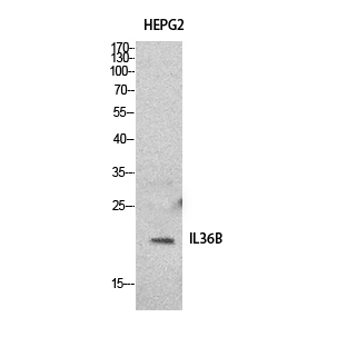 Fig.1. Western Blot analysis of HepG2 cells using IL-1F8 Polyclonal Antibody. Secondary antibody (catalog#: A21020) was diluted at 1:20000.
