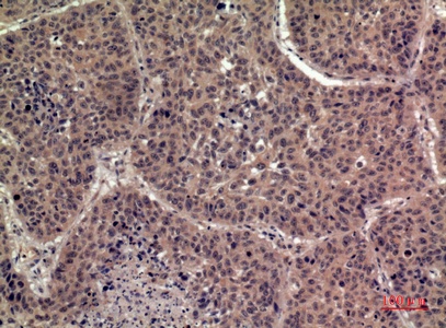 Fig.3. Immunohistochemical analysis of paraffin-embedded human-lung, antibody was diluted at 1:100.