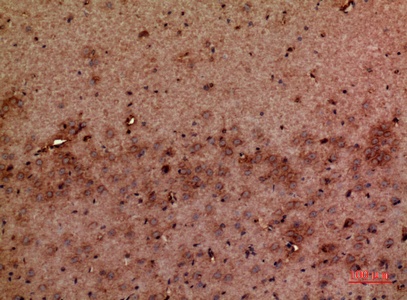 Fig.2. Immunohistochemical analysis of paraffin-embedded Mouse-brain, antibody was diluted at 1:100.