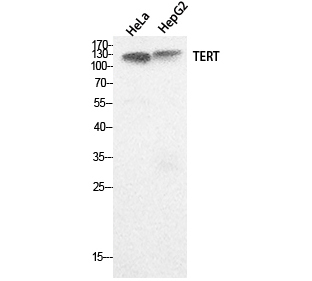 Fig.1. Western Blot analysis of hela, HepG2 cells using TERT Polyclonal Antibody. Secondary antibody (catalog#: A21020) was diluted at 1:20000.