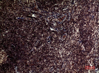 Fig.2. Immunohistochemical analysis of paraffin-embedded human-tonsilla, antibody was diluted at 1:100.