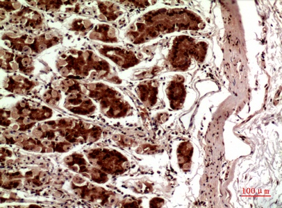 Fig.3. Immunohistochemical analysis of paraffin-embedded human-stomach, antibody was diluted at 1:100.