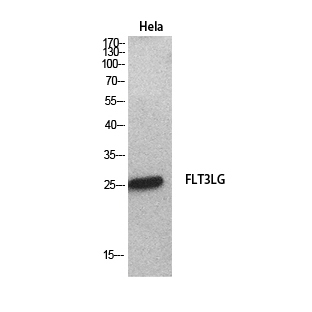 Fig. Western Blot analysis of hela cells using Flt3-L Polyclonal Antibody. Secondary antibody (catalog#: A21020) was diluted at 1:20000.