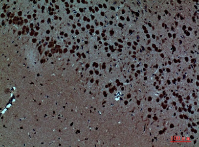 Fig.5. Immunohistochemical analysis of paraffin-embedded Mouse-brain, antibody was diluted at 1:100.