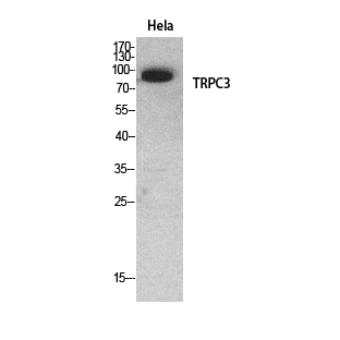 Fig.1. Western Blot analysis of hela cells using TRPC3 Polyclonal Antibody. Secondary antibody (catalog#: A21020) was diluted at 1:20000.