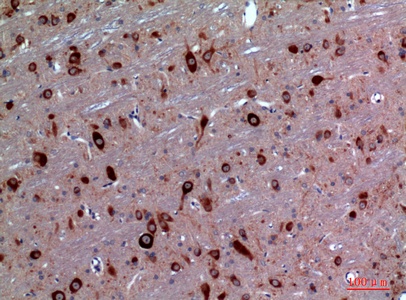 Fig.2. Immunohistochemical analysis of paraffin-embedded rat-brain, antibody was diluted at 1:100.