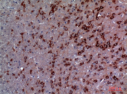 Fig.3. Immunohistochemical analysis of paraffin-embedded rat-brain, antibody was diluted at 1:100.