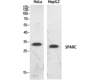 Fig.1. Western Blot analysis of hela, HepG2 cells using SPARC Polyclonal Antibody. Secondary antibody (catalog#: A21020) was diluted at 1:20000.