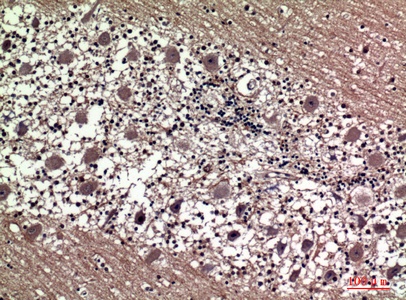 Fig.2. Immunohistochemical analysis of paraffin-embedded human-brain, antibody was diluted at 1:100.