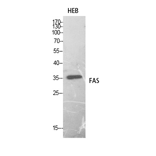 Fig. Western Blot analysis of HEB cells using FAS Polyclonal Antibody. Secondary antibody (catalog#: A21020) was diluted at 1:20000.