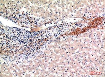 Fig.2. Immunohistochemical analysis of paraffin-embedded human-liver, antibody was diluted at 1:100.