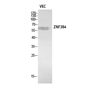 Fig. Western Blot analysis of VEC cells using ZNF384 Polyclonal Antibody. Secondary antibody (catalog#: A21020) was diluted at 1:20000.