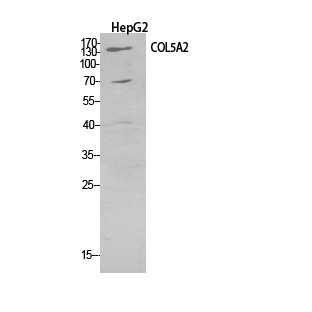 Fig.1. Western Blot analysis of HepG2 cells using COL5A2 Polyclonal Antibody. Secondary antibody (catalog#: A21020) was diluted at 1:20000.