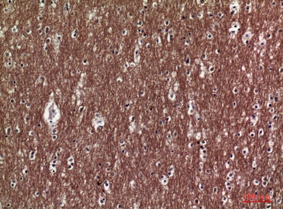 Fig.3. Immunohistochemical analysis of paraffin-embedded human-brain, antibody was diluted at 1:100.