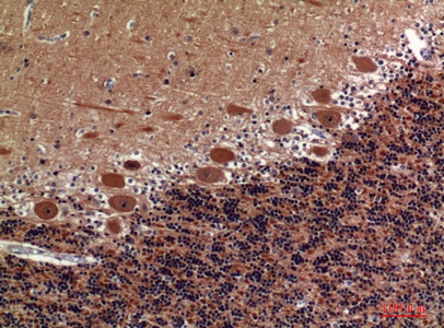 Fig.4. Immunohistochemical analysis of paraffin-embedded human-brain, antibody was diluted at 1:100.