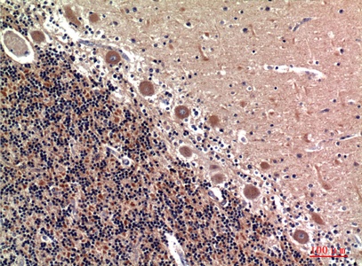Fig.4. Immunohistochemical analysis of paraffin-embedded human-brain, antibody was diluted at 1:100.
