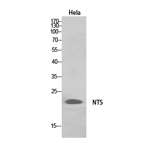 Fig. Western Blot analysis of hela, HepG2 cells using Neurotensin Polyclonal Antibody. Secondary antibody (catalog#: A21020) was diluted at 1:20000.