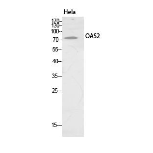 Fig.1. Western Blot analysis of hela cells using OAS2 Polyclonal Antibody. Secondary antibody (catalog#: A21020) was diluted at 1:20000.