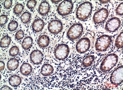 Fig.2. Immunohistochemical analysis of paraffin-embedded human-uterus, antibody was diluted at 1:100.