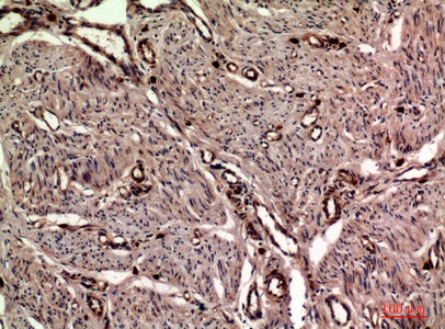 Fig.3. Immunohistochemical analysis of paraffin-embedded human-uterus, antibody was diluted at 1:100.