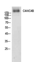 Fig.1. Western Blot analysis of AD293 cells using C4a/b Polyclonal Antibody. Secondary antibody (catalog#: A21020) was diluted at 1:20000.