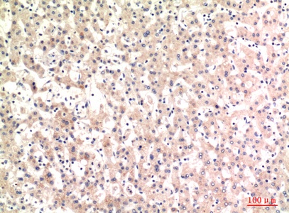 Fig.2. Immunohistochemical analysis of paraffin-embedded human-liver, antibody was diluted at 1:100.