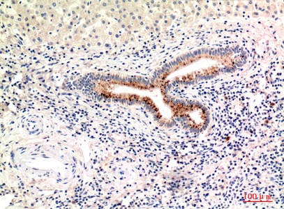Fig.3. Immunohistochemical analysis of paraffin-embedded human-liver, antibody was diluted at 1:100.