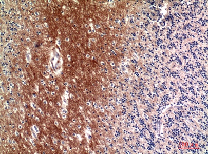 Fig.4. Immunohistochemical analysis of paraffin-embedded human-brain, antibody was diluted at 1:100.