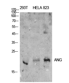 Fig.1. Western Blot analysis of 293T, hela, 823 cells using ANG I Polyclonal Antibody. Antibody was diluted at 1:500. Secondary antibody (catalog#: A21020) was diluted at 1:20000.