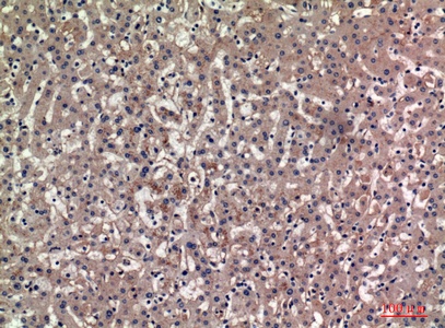 Fig.2. Immunohistochemical analysis of paraffin-embedded human-liver, antibody was diluted at 1:100.