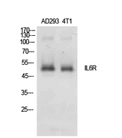 Fig. Western Blot analysis of AD293, 4T1 cells using IL-6Rα Polyclonal Antibody. Secondary antibody (catalog#: A21020) was diluted at 1:20000.