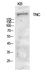 Fig.1. Western Blot analysis of KB cells using Tenascin-C Polyclonal Antibody. Antibody was diluted at 1:1000. Secondary antibody (catalog#: A21020) was diluted at 1:20000.