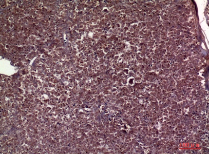Fig.2. Immunohistochemical analysis of paraffin-embedded human-pancreas, antibody was diluted at 1:100.