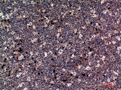 Fig.3. Immunohistochemical analysis of paraffin-embedded human-tonsils, antibody was diluted at 1:100.