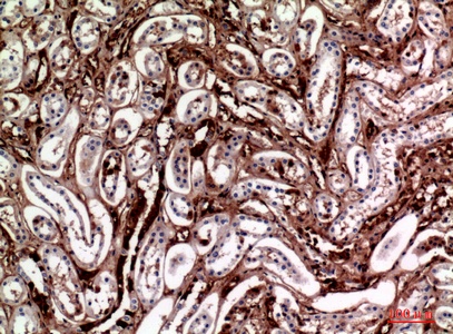 Fig.5. Immunohistochemical analysis of paraffin-embedded human-kidney, antibody was diluted at 1:100.