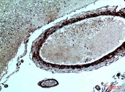Fig.3. Immunohistochemical analysis of paraffin-embedded human-brain, antibody was diluted at 1:100.